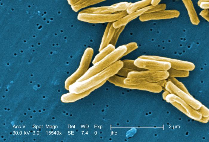an image of the Tuberculosis bacteria